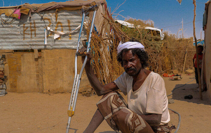 Man holding crutch sitting on floor in front of shelters in Yemen